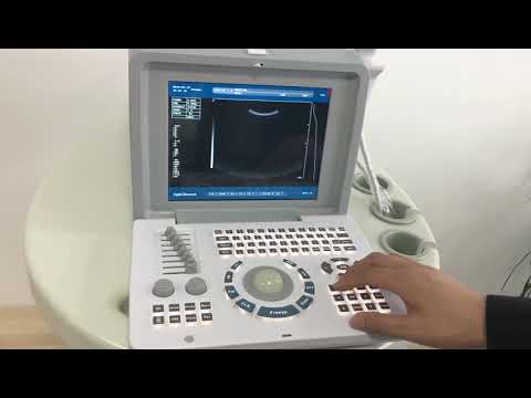laptop Ultrasound scanner HBW-2