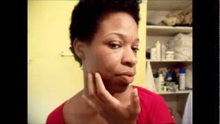 CHEMICAL PEEL DAY2 MORNING.wmv