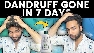 How to REMOVE DANDRUFF from hair at HOME in 7 days | SELSUN Shampoo