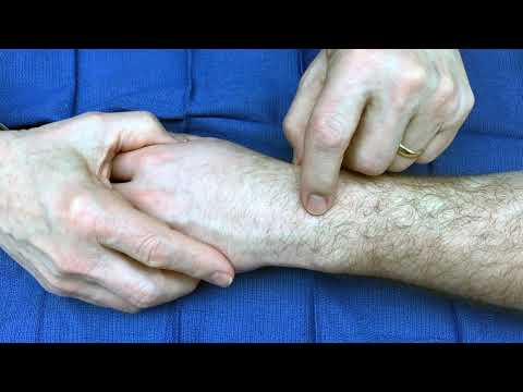 Kaplan's Cardinal Line, Other Topographical Lines, and Surface Anatomy of Hand and Wrist