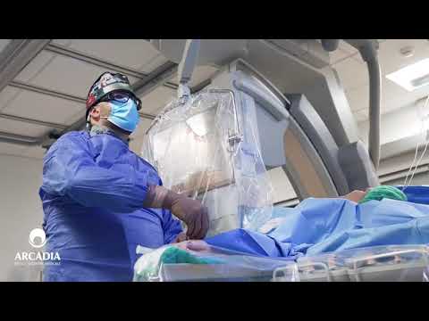 Embolizarea fibromului uterin