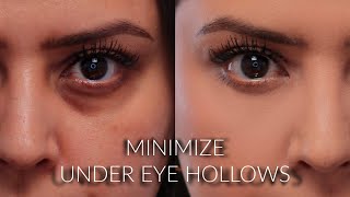 How To Minimize the Appearance of Under-Eye Hollows and Conceal Dark Circles
