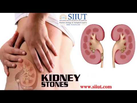 Kidney stone treatment, For For Treating Kidney Stone