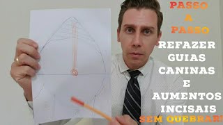 🛑COMO REFAZER GUIAS CANINA ( E DE INCISIVOS : AUMENTOS INCISAIS) SEM QUEBRAR NA PRÁTICA!🤔🤫🔥