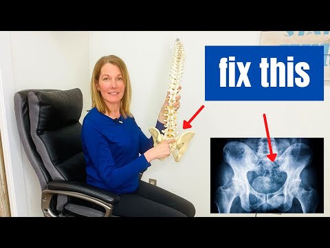 SI Joint Dysfunction | Symptoms and Fixes