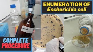 Download lagu Enumeration of Escherichia coli (Total E. coli Count)_A Complete Procedure (ISO 9308-1 & ISO 16649) mp3