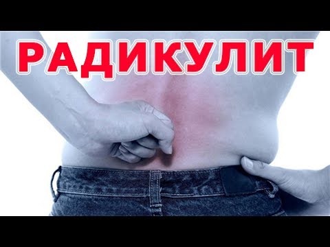 Rückenschmerzen im Lendenwirbelbereich Ursachen für Medikamente Eine harte Stütze auf dem Kniegelenk in Moskau kaufen