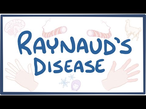 Raynaud Phenomenon - causes, symptoms, diagnosis, treatment, pathology
