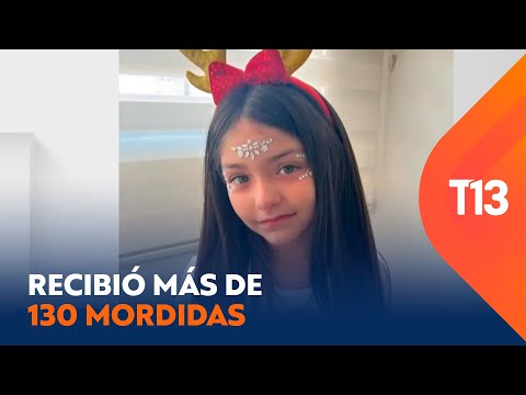 El impactante relato de la madre de niña atacada por los perros de su abuelo