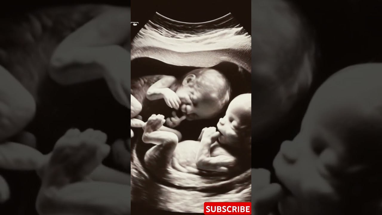 Twins in Ultrasound: The Secret Life of Your Fetus