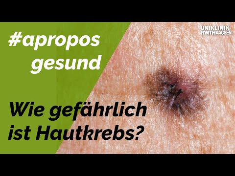 #aproposgesund Thema: Wie gefährlich ist Hautkrebs?
