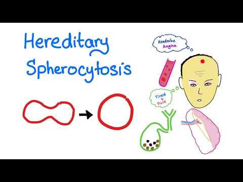 Hereditary Spherocytosis (HS) - Red Blood Cell Disorders - Hematology