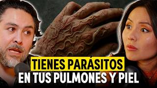 Experto en Parásitos: 10 SEÑALES Ocultas de que Tienes PARÁSITOS y Cómo Eliminarlos