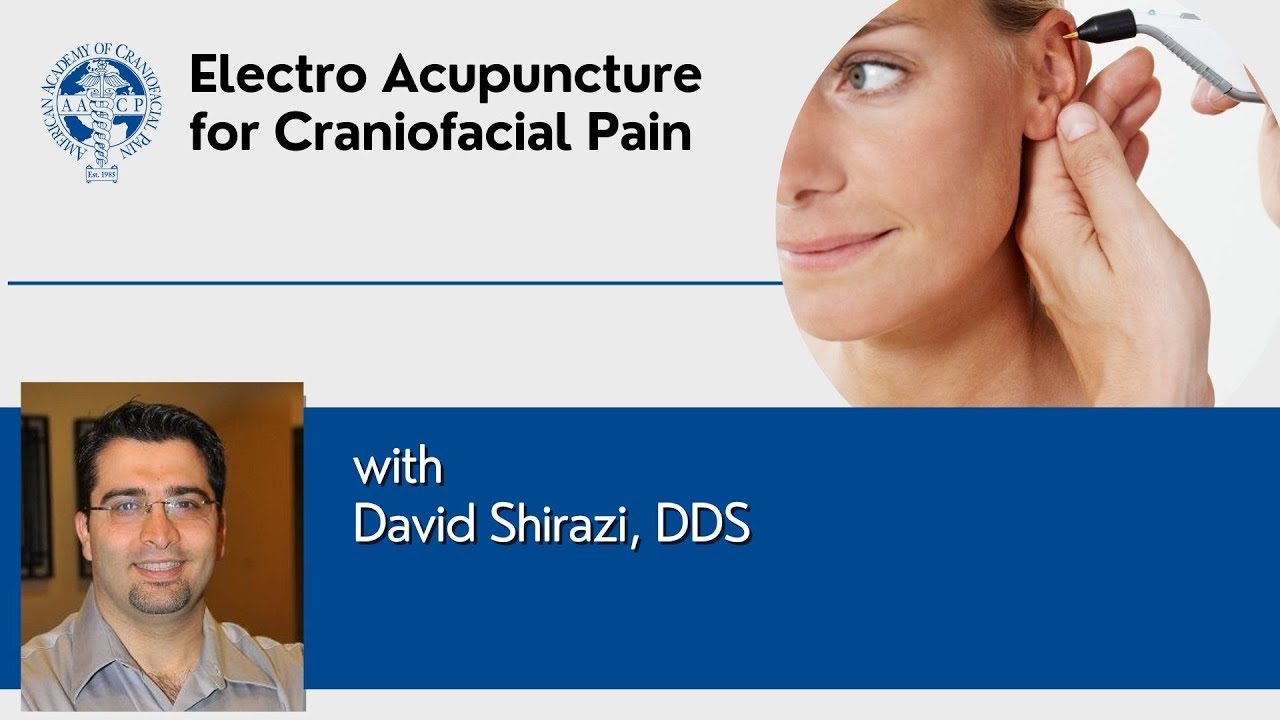 Electro Acupuncture for CranioFacial Pain: Dr. David Shirazi - YouTube