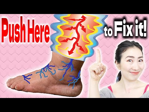 🦶How to Quickly Remove Swelling & Slim Legs and Feet with the Best Acupoint! | Lymphatic Drainage