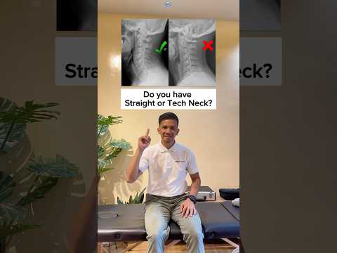 Stretch your straight neck away!! #spondylosis