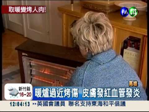 電暖器"烤人肉" 出現紅斑.血管炎