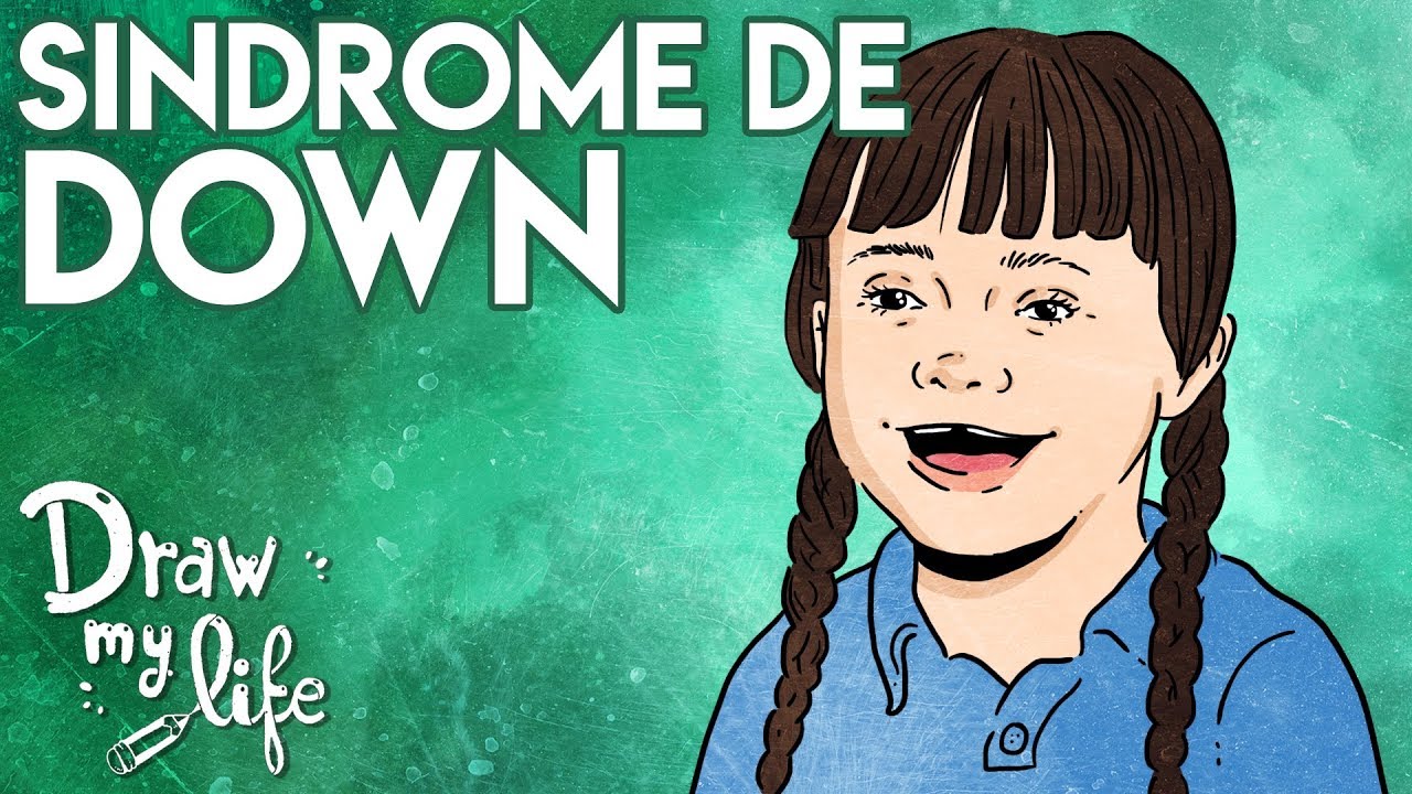 Watch SÍNDROME de DOWN ¿QUÉ es | Draw My Life Now SÍNDROME de DOWN ¿QUÉ es | Draw My Life