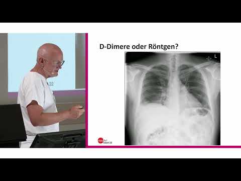 medArt2022 Freitag 01 Lungenembolie - R Bingisser