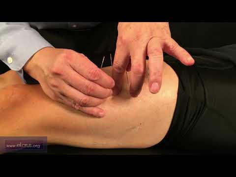 Đổng thị kỳ huyệt  - TỨ MÃ TRUNG - TỨ MÃ THƯỢNG - TỨ MÃ HẠ