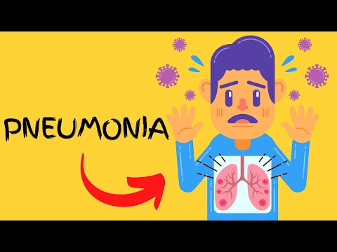 What is Pneumonia - Symptoms, Causes, Types