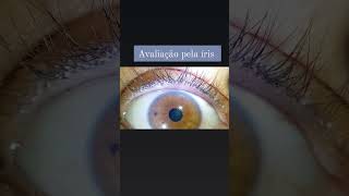 Nunca viu a sua íris? #iridologia #tratamentosnaturais #iris #naturopatia #novaprofissão