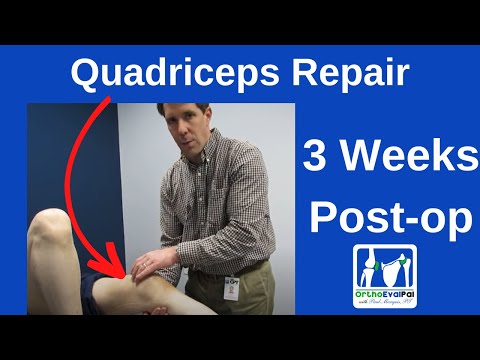Quadriceps Repair 3 Weeks Post Op