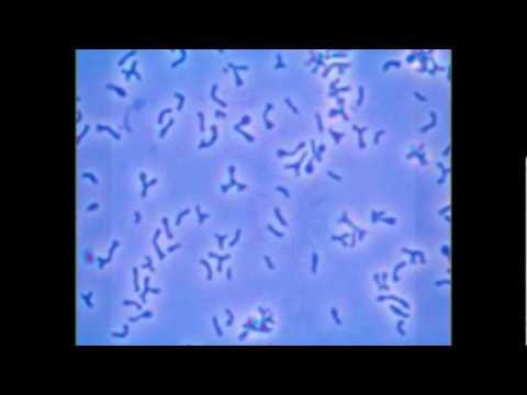 Thyroxine na uminom diyeta Kung paano mag-ehersisyo upang mangayayat
