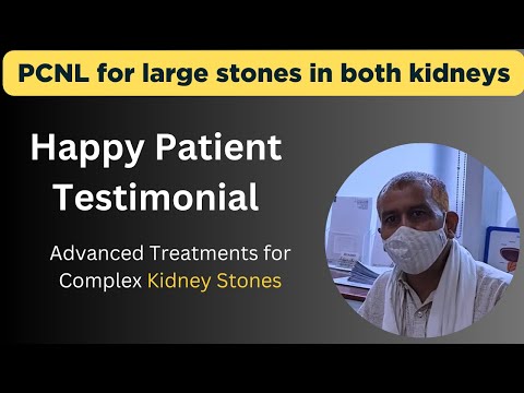 Patient Story - Complex Kidney Stone Treated Successfully
