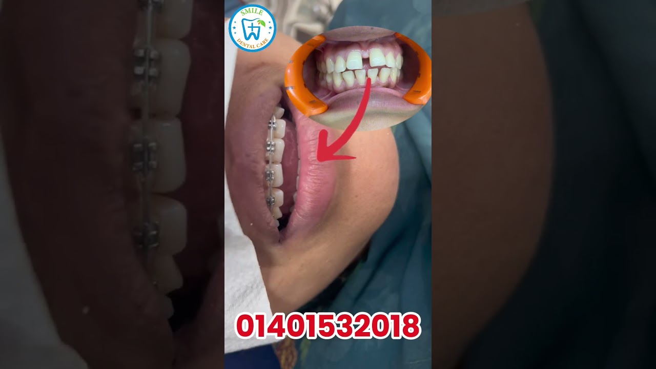 একজন নার্স যখন আমাদের এখানে চিকিৎসা নেয়, শুনুন তার অনুভূতি। - ভিডিও পর্যালোচনা