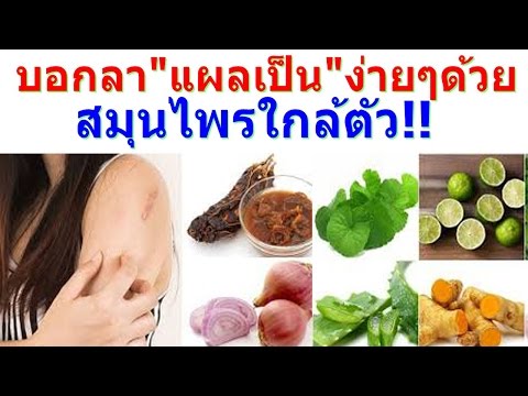 รูปภาพของโรคสะเก็ดเงินพื้นที่ขน กลากที่มีภาพถ่ายหนอง