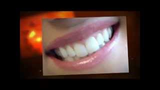 preview picture of video 'Weston Cosmetic Dentist |Call & Get This Spot| Weston Cosmetic Dentistry'