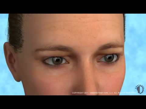 ooglidcorrectie amsterdam