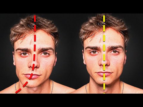 How to Fix the Asymmetries of Your Face and Jaw (Forever)