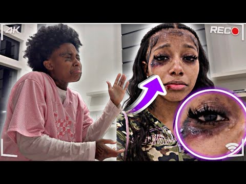 I GOT BEAT UP BAD & SHOWED MY FIANCEE 😱 * NO JOKE *