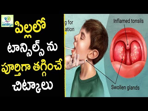 Home Remedies For Tonsils - Health Tips in Telugu || Mana Arogyam