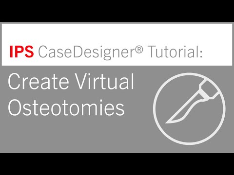 Workflow 5 - Create Virtual Osteotomies | IPS CaseDesigner® Tutorial