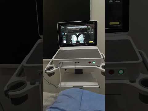 Why Choose Ultherapy PRIME? Non-Surgical Face Lift