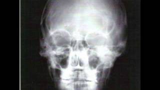 Malkovich Music- Everything's Perfect