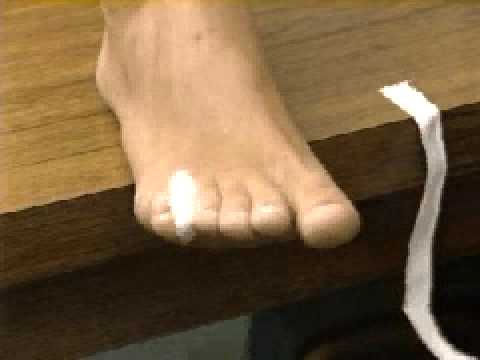 comment soigner une fracture d'un doigt de pied