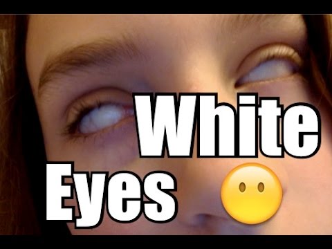 White Eyes!