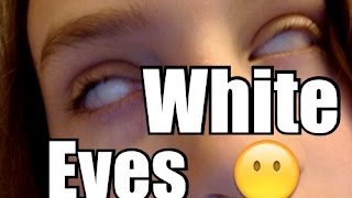 White Eyes!
