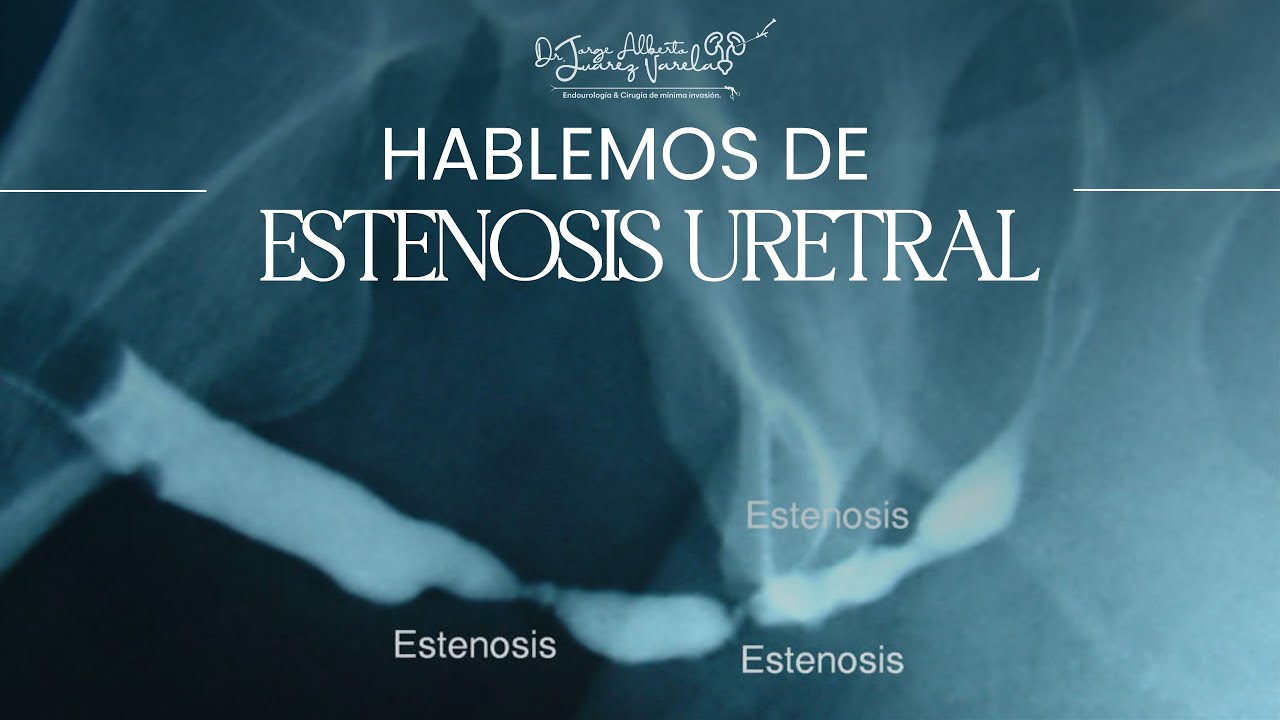 Jorge Alberto Juárez Varela-76