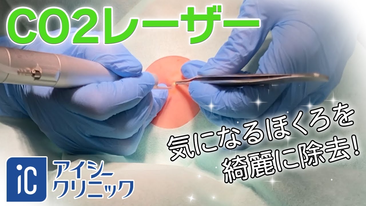 CO2レーザー 施術動画 アイシークリニック