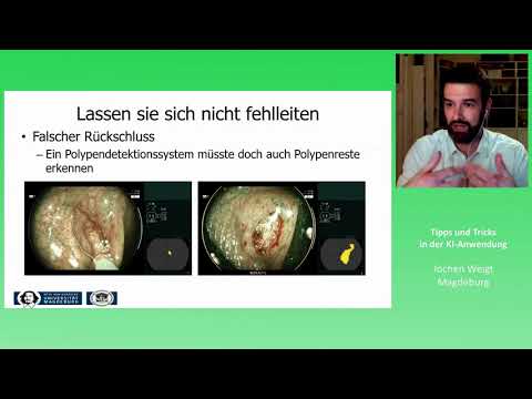 DGE-BV online symposium – Intelligente Systeme in der Endoskopie, Tipps und Tricks for Endo KI Weigt
