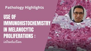 Immunohistochemistry in melanocytic tumors (introduction)