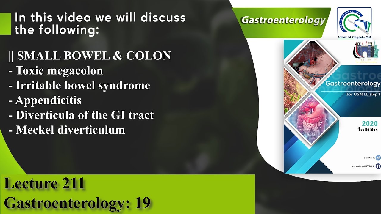 Toxic megacolon | Irritable bowel syndrome | Appendicitis | Diverticulosis | Meckel diverticulum