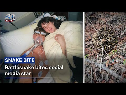 Rattlesnake bites social media star, sends him to UF Health Shands ICU: ‘Welp, I’m cooked'