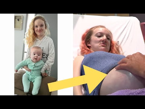 Ein großes Wunder geschah mit einer jungen Mutter, die praktisch keine Muskeln hat!