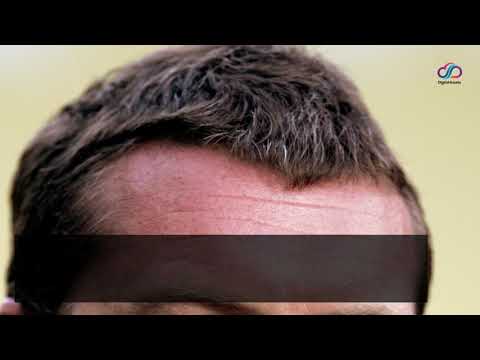 Automotive suppliers: the “Sam” of Decazeville demonstrate to defend employment